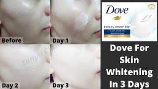 Permanent Skin Whitening With Dove  Get Fair Skin In Just 3 Days  Skin Whitening Home Remedies [upl. by Eves]