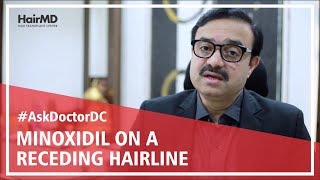 Does Minoxidil Work On Receding Hairline  HairMD Pune [upl. by Jase181]