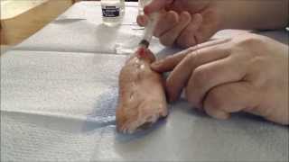 How to Draw up and Inject Lidocaine  Part 2  Video 1 of 2 [upl. by Trebla]