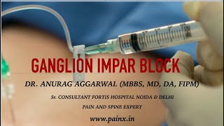 GANGLION IMPAR BLOCK [upl. by Niajneb834]