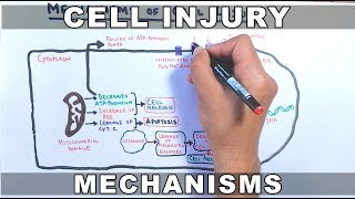 Mechanisms of Cell Injury [upl. by Haran159]