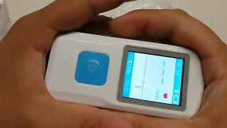 FL10 Portable ECG Monitor [upl. by Leblanc]