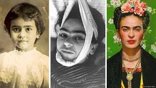 La trágica historia de Frida Kahlo [upl. by Yznyl568]