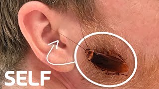 Can a Cockroach Get Stuck in Your Ear  How Common Is It  SELF [upl. by Jacques508]