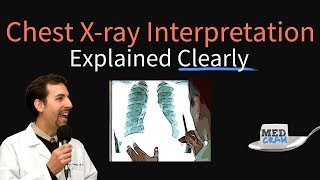 Chest XRay Interpretation Explained Clearly  How to read a CXR [upl. by Lyrret]