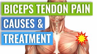 Biceps Tendonitis Treatment and Exercises Explained [upl. by Dett]