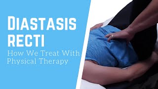 How We Treat Diastasis Recti  Physical Therapy [upl. by Pyle]