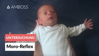 MoroReflex  Frühkindliche Reflexe  AMBOSS Video [upl. by Middlesworth]