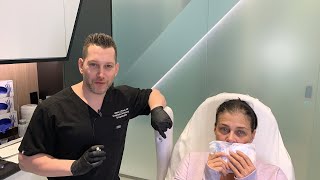 Female Facial Sculpting with Belotero  Smokers Lines and Lip Rejuvenation  West Hollywood CA [upl. by Puiia]