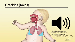 Respiratory Assessment by B Leary L DelSignore  OPENPediatrics [upl. by Issiah]