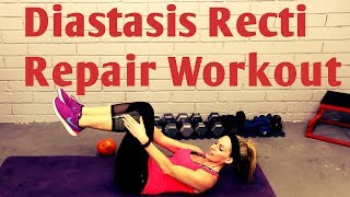 15 Minute Diastasis Recti Repair WorkoutPostnatal Core After Pregnancy [upl. by Idur]