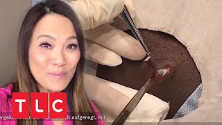 Dr Sandra Lee entfernt Zyste mit Skalpell  Dr Pimple Popper  TLC Deutschland [upl. by Feune946]