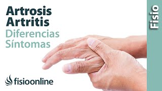 ¿Cómo entender y minimizar los síntomas de la Artrosis de rodilla [upl. by Lattimer]