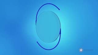 What is a monofocal intraocular lens IOL [upl. by Malkin303]