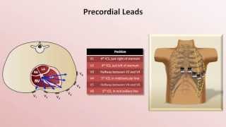 Intro to EKG Interpretation  EKG Leads [upl. by Enilraep799]