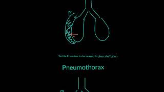 Tactile Fremitus Explained [upl. by Nielson957]