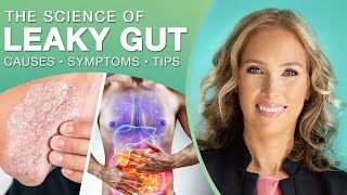 The Science of Leaky Gut  Everything You Need to know About Leaky Gut [upl. by Jacobsen746]