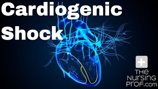 How to Manage Cardiogenic Shock [upl. by Maximo318]