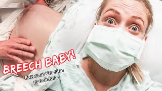 Breech Baby Turning Vlog  Third Trimester Pregnancy [upl. by Birchard]