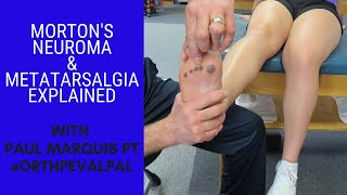 Mortons Neuroma and Metatarsalgia Whats the Difference [upl. by Uriiah]