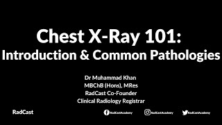 RadCast Academy Introduction To The Chest XRay amp Common Pathologies cxr radcast [upl. by Angele940]