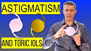 Astigmatism and cataract surgery  proper cataract lens choice [upl. by Gignac552]