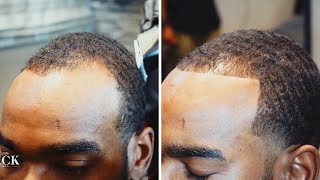 Barber Shows How To Get Your Thinning Hairline Back  Barber Spotlight 4 Tahir Woods [upl. by Lettie]