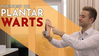 Plantar Warts Explained  Lewis Nurney Singapore Podiatrist [upl. by Rodie]