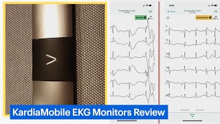 KardiaMobile Personal EKG Monitors Review [upl. by Phil]