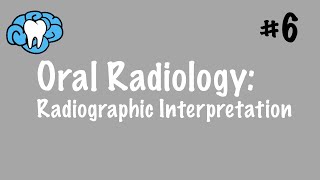 Oral Radiology  Radiographic Interpretation  INBDE ADAT [upl. by Harden]