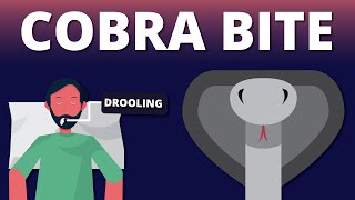 A case of Cobra Bite Emergency Snake Venom Animation [upl. by Addy232]