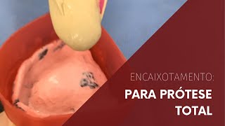 Encaixotamento para Prótese Total [upl. by Niwrehs389]