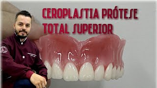 Ceroplastia de uma protese total superiorpasso a passo [upl. by Nnorahs89]