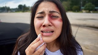 I Got Beat Up Prank on Boyfriend Jehiely N Alex [upl. by Ahsiloc436]