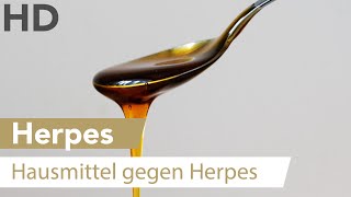 Herpes an der Lippe Dieses natürliche Hausmittel kann helfen [upl. by Otreblide691]