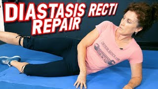 Top 5 Exercises to REPAIR Diastasis Recti [upl. by Tadeas]