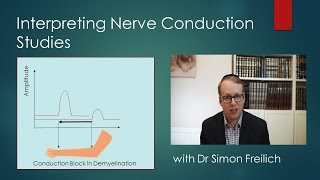 Interpreting Nerve Conduction Studies [upl. by Aiker817]