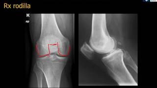 Anatomía Rx Rodilla [upl. by Deadman]