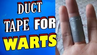 How To Remove Warts amp Verrucas Using Duct Tape [upl. by Notnarb]