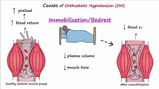 Orthostatic Hypotension Described Concisely [upl. by Ambrosine]