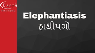 Elephantiasis  હાથીપગો  Human Health and Diseases  11th science biology [upl. by Naira593]