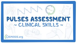 Clinical Skills Pulses assessment [upl. by Benedetta]