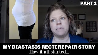 My Diastasis Recti Repair Story  From Exercises to Surgery [upl. by Reisch]