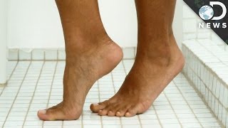 What Causes Warts [upl. by Osmen]