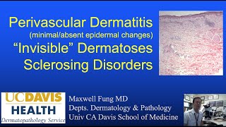 How to treat Perioral Dermatitis Dermatologist Explains [upl. by Berthoud18]