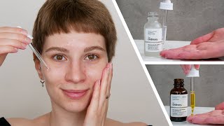 How To Use The Ordinary Niacinamide and Rosehip Seed Oil [upl. by Bo]