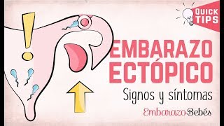 EMBARAZO ECTÓPICO 💔😭 Signos y síntomas [upl. by Naehs970]