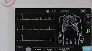 How to Use the Welch Allyn CP150 EKG Machine and Product Features [upl. by Martinsen]