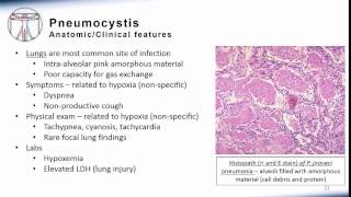 5 Pneumonia Pneumocystis [upl. by Yevi949]