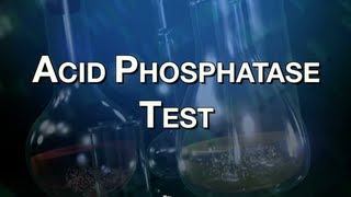 Acid Phosphatase Test [upl. by Nivel]